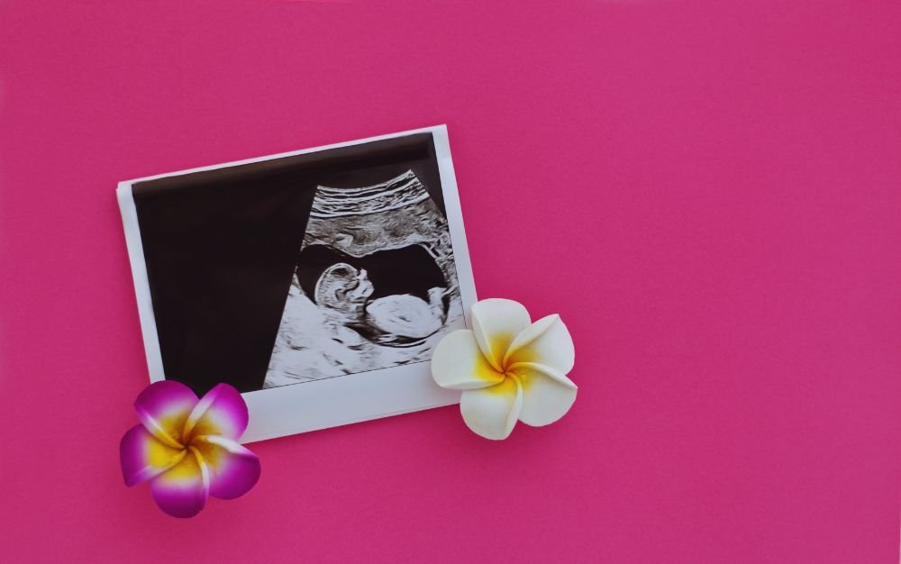 ultraschallbild eines fötus auf himbeerrotem hintergrund mit zwei blumen, quadratisches format